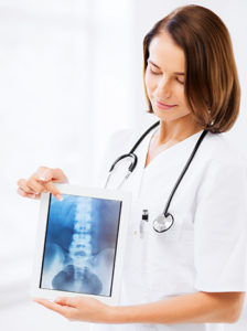 female doctor holding xray of spine and pelvis
